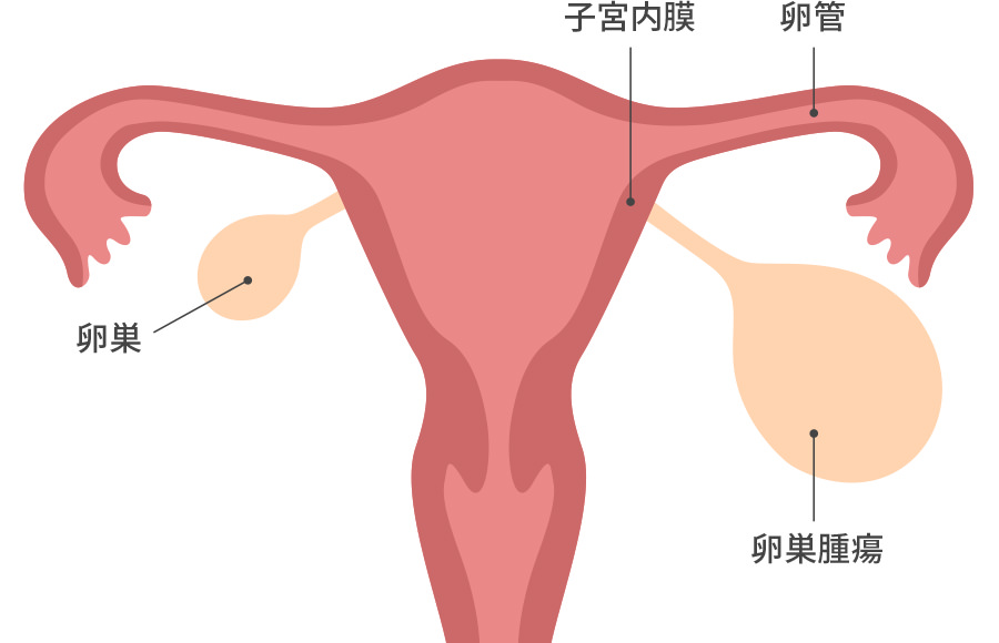 婦人科腹腔鏡下手術 | 婦人科・ヘルスケア（更年期）外来 | 熊本の産婦人科 福田病院（熊本県熊本市）